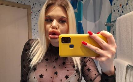 “La Barbie humana” llega con sus enormes labios a OnlyFans