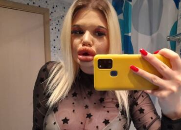 “La Barbie humana” llega con sus enormes labios a OnlyFans