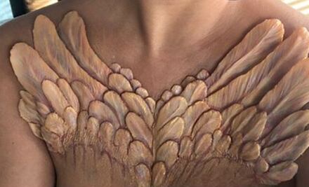 Implantes temporales, la nueva tendencia entre las celebridades