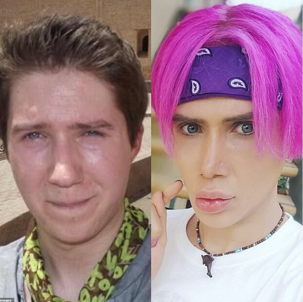 Influencer se realiza 18 cirugías para lucir como integrante de BTS