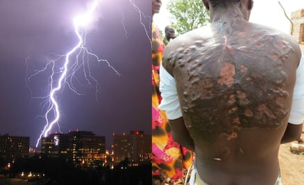 Figuras de Lichtenberg, los “tatuajes” naturales creados por los rayos