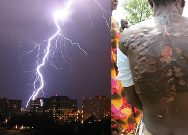 Figuras de Lichtenberg, los “tatuajes” naturales creados por los rayos