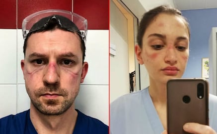 10 fotos de las duras jornadas de médicos y enfermeras contra el Covid-19