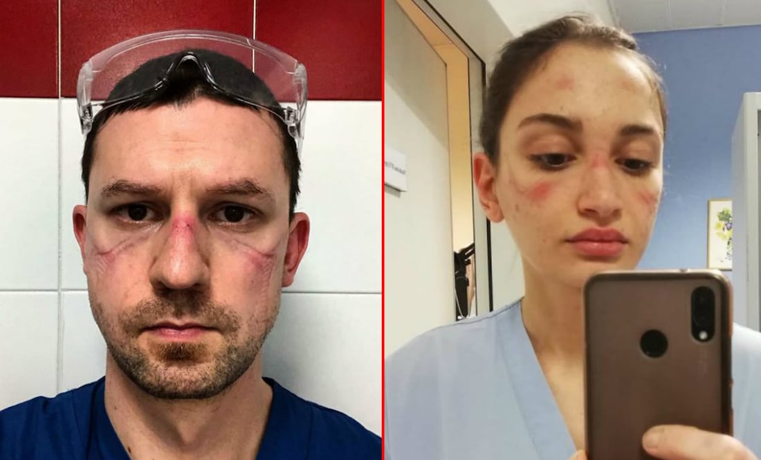 Fotos: Facebook Nicola Sgarbi/Instagram @alessiabonari_