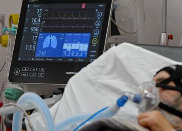 Marburgo, el virus que “escapó” del laboratorio y es mortal