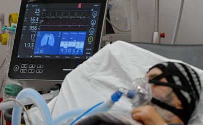 Foto: AP